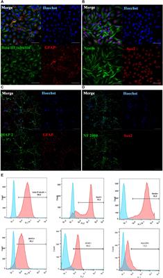 Intra-Arterial Stem Cell Transplantation in Experimental Stroke in Rats: Real-Time MR Visualization of Transplanted Cells Starting With Their First Pass Through the Brain With Regard to the Therapeutic Action